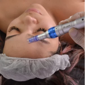 terapia de microneedling facial